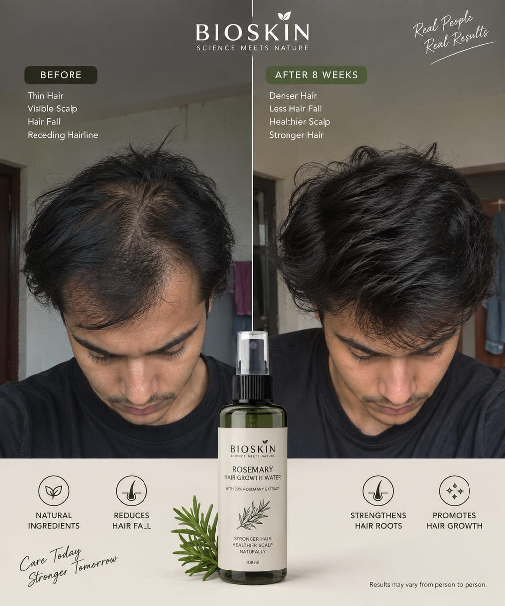 Hair Grow Rosemary Spray by Bioskin
