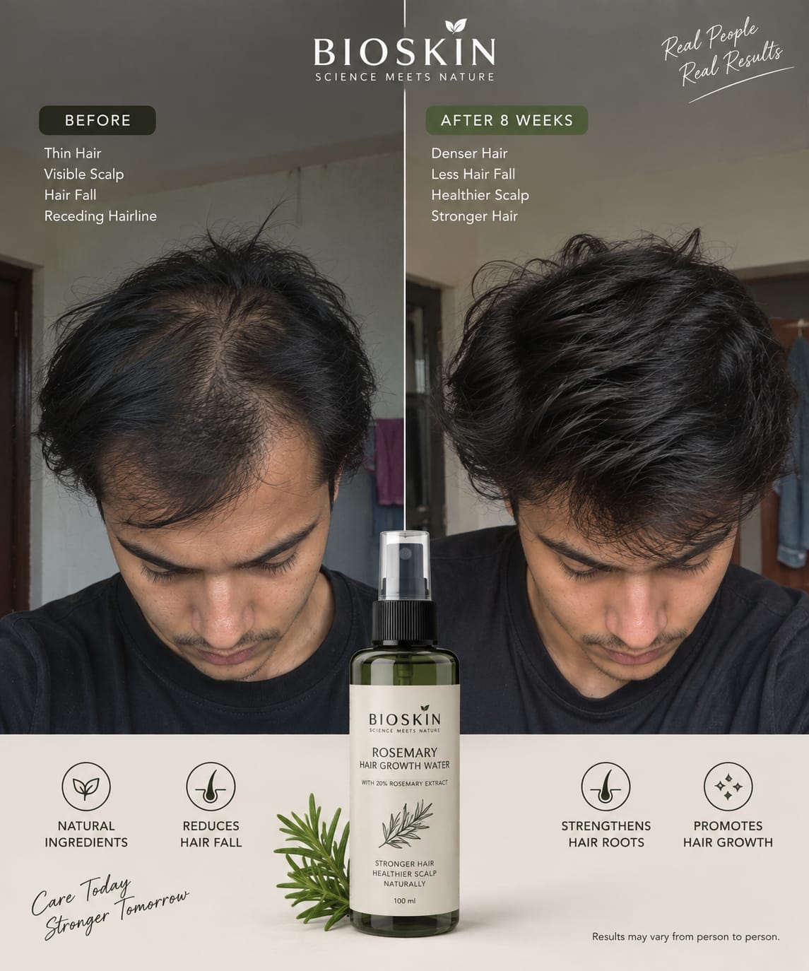 Hair Grow Rosemary Spray by Bioskin
