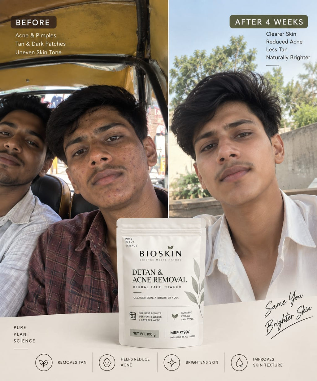 De-tan & Acne removal Face pack by Bioskin (100gm)